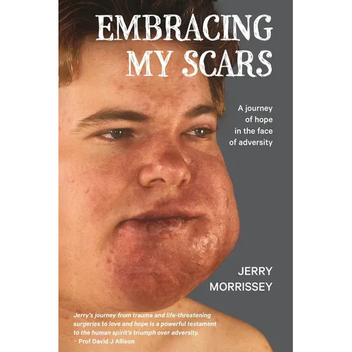 Embracing My Scars: A journey of hope in the face of adversity - Paperback