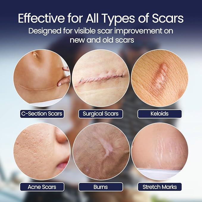 Silicone Scar Patches | Medical-Grade & Hypoallergenic Scar Care for Surgery, C Section Recovery, Keloids, Burns & Stretch Marks | 18 Pre-Cut Flexible Acne Scar Strips
