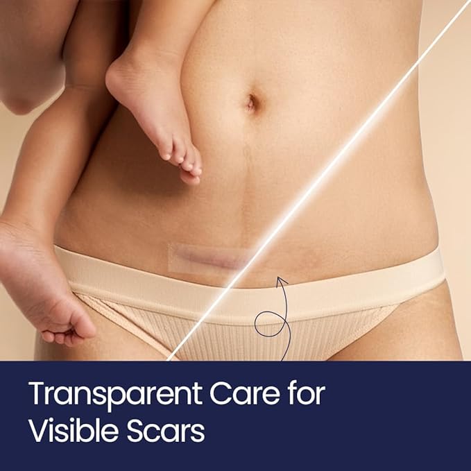 Silicone Scar Patches | Medical-Grade & Hypoallergenic Scar Care for Surgery, C Section Recovery, Keloids, Burns & Stretch Marks | 18 Pre-Cut Flexible Acne Scar Strips