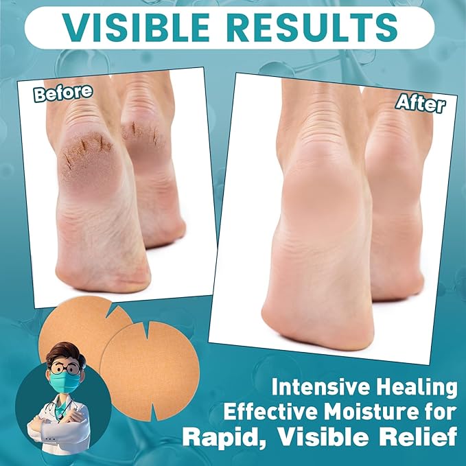 TEAWOO 20PCS Patented Cracked Heel Treatment Patches, Cracked Heel Repair Bandage (100mm x 100mm)