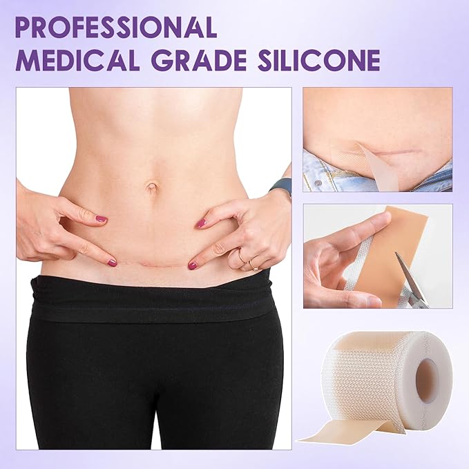 2Pcs Hyaluronic Acid Silicone Scar Tape,Silicone Scar Tape,Silicone Scar & Wrinkle Tape,Scar tape for all skin types