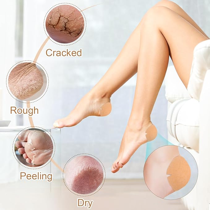 TEAWOO 20PCS Patented Cracked Heel Treatment Patches, Cracked Heel Repair Bandage (100mm x 100mm)