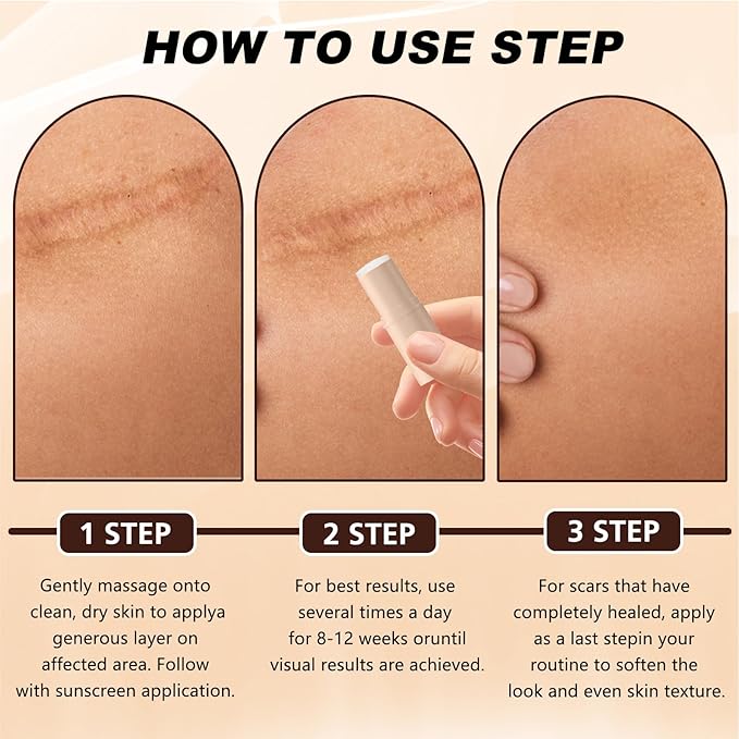 2pcs Scar Solutions Silicone Scar Stick, Made of 60% Silicone, Lightweight & Easy to Apply, Gentle on All Skin Types