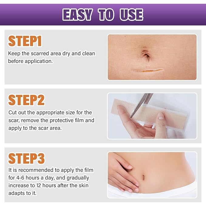 Silicone Scar Sheets, Medical Grade Silicone Scar Tape for Surgical, Hypertrophic, Keloid, C-Section, Burn, Old & New Scars, Reusable Professional Scars Removal Sheets (1.6"X 59" Roll-1.5M)
