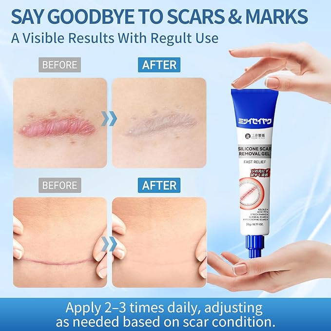 DRMITSUI Silicone Scar Gel for Old and New Scars, Scar Treatment for Acne Surgical Burn and Stretch Marks, Medical Grade Silicone Scar Gel, Fast Absorbing, 20g 0.71oz (Pack of 2)