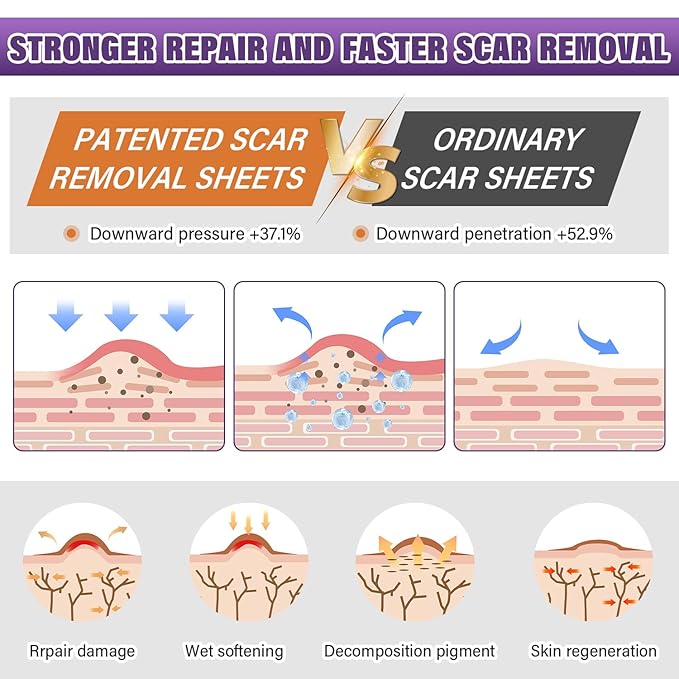 Silicone Scar Sheets, Medical Grade Silicone Scar Tape for Surgical, Hypertrophic, Keloid, C-Section, Burn, Old & New Scars, Reusable Professional Scars Removal Sheets (1.6"X 120" Roll-3M)