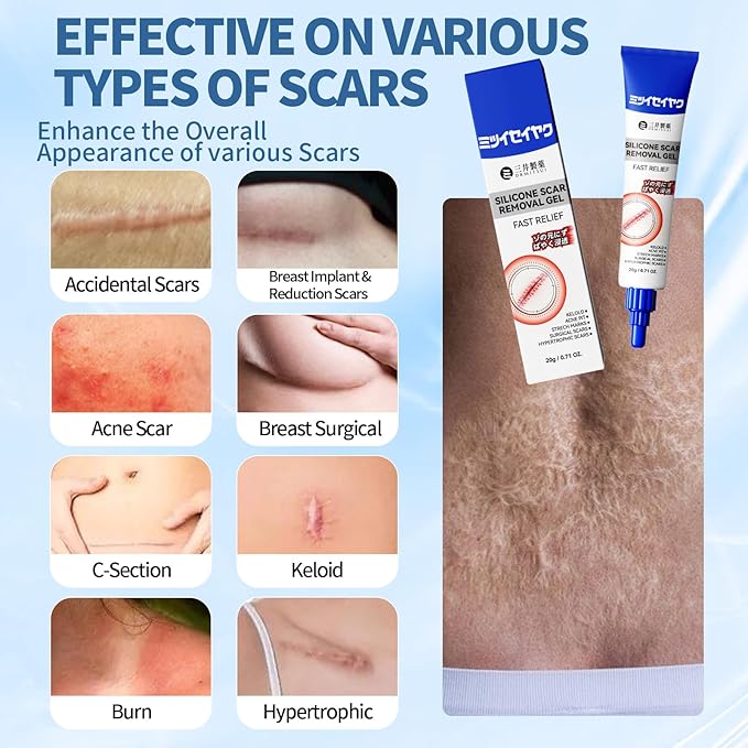 DRMITSUI Silicone Scar Gel for Old and New Scars, Scar Treatment for Acne Surgical Burn and Stretch Marks, Medical Grade Silicone Scar Gel, Fast Absorbing, 20g 0.71oz (Pack of 3)