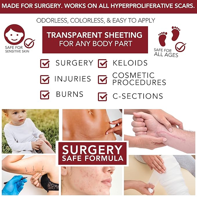 HealFast Silicone Scar Gel & Cream for Surgical Scars - Medical Grade Scar Treatment & Removal for Keloid, Acne, Burns, C Section, Stretch Marks - Physician Formulated Advanced Silicone Gel for Scars