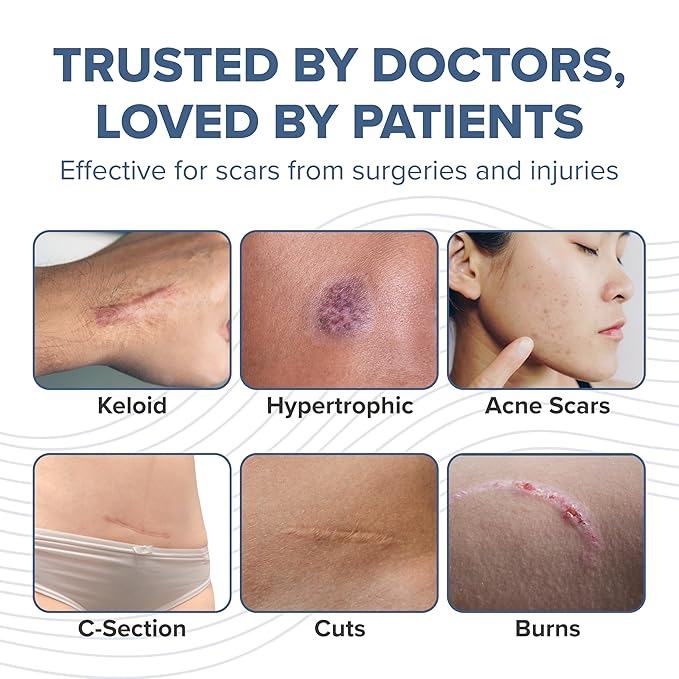 PROSIL Silicone Scar Stick 4.25 g – Medical Grade Silicone Scar Treatment for New & Old Scars – Mess Free, Glide On Scar Therapy Stick for Face & Body – Compact, Travel-Friendly Scar Care for Adults