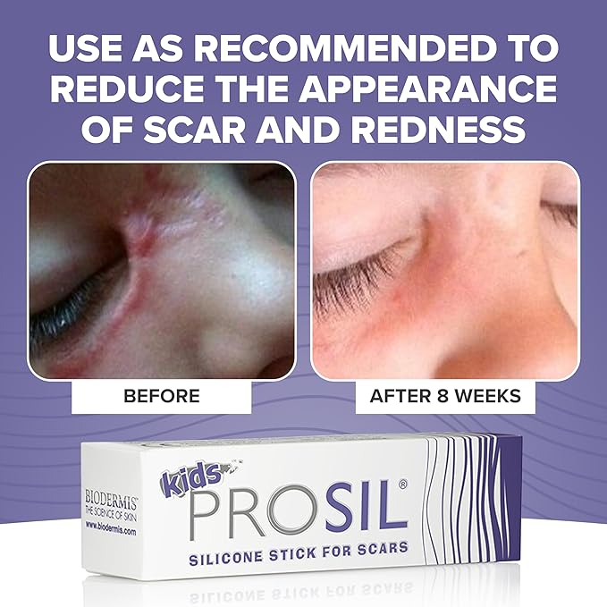 Pro-SIL Kids 4.25g – Mess-Free, Glide-On Silicone Stick for Kids – Hypoallergenic, Non-Toxic Silicone Formula – Pocket-Sized Scar Treatment for On-the-Go Use – Ideal for Exposed Scars on Face & Body
