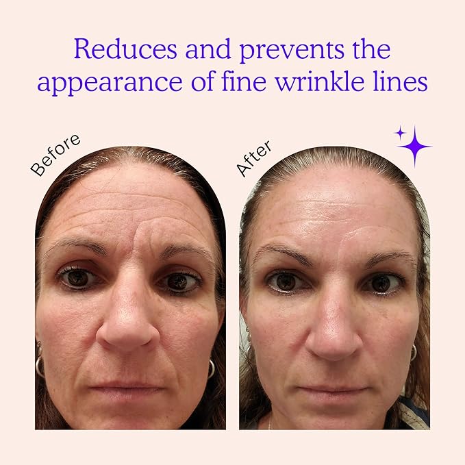 BLUMBODY Face, Forehead Wrinkle Patches - Anti Wrinkle Facial Patches to Smooth Eye, Mouth, Forehead Wrinkles - Non-Silicone Face Tape for Fine Wrinkles between Eyes, Face - Patches (30 day supply)