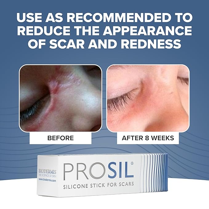 PROSIL Silicone Scar Stick 4.25 g – Medical Grade Silicone Scar Treatment for New & Old Scars – Mess Free, Glide On Scar Therapy Stick for Face & Body – Compact, Travel-Friendly Scar Care for Adults
