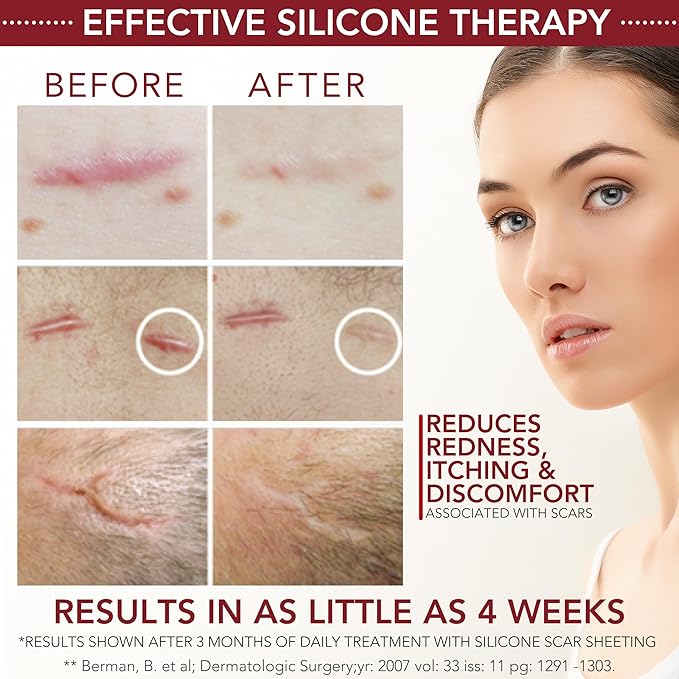 HealFast Silicone Scar Gel & Cream for Surgical Scars - Medical Grade Scar Treatment & Removal for Keloid, Acne, Burns, C Section, Stretch Marks - Physician Formulated Advanced Silicone Gel for Scars