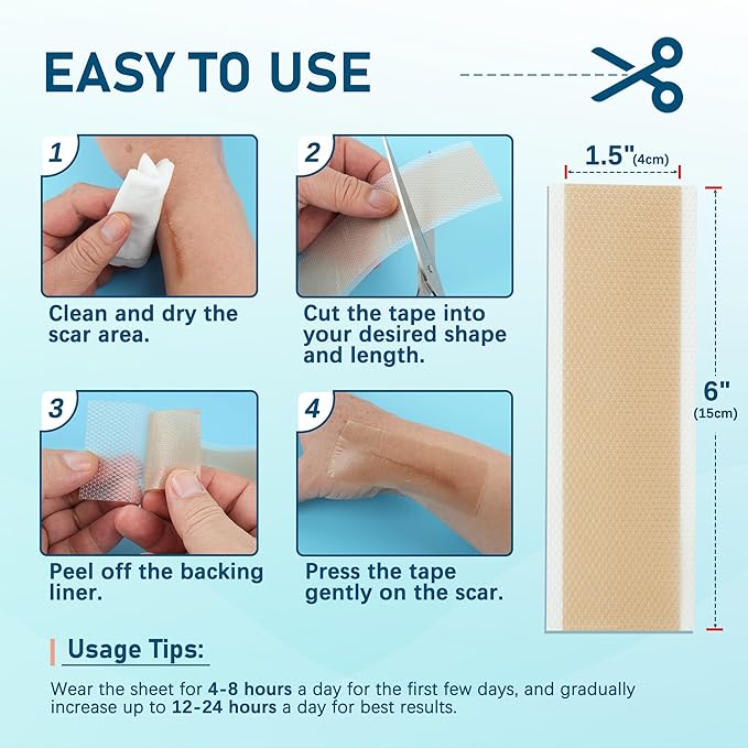 Silicone Scar Sheets, 10pcs, Silicone Tape for Scar Treatment, Reusable Scar Strips for Surgical, C-Section, Keloid Bump, Stretch Marks, Burn, Acne Scar Removal, Each 1.5” x 6”