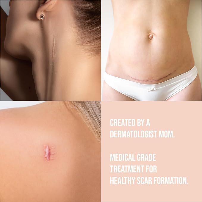 Quitch Silicone Scar Sheets for Surgical Scars, Silicone Scar Tape, C Section Recovery Must Haves, Tummy Tuck Recovery Must Haves, Postpartum Essentials Scar Treatment (Floral) 4x150cm