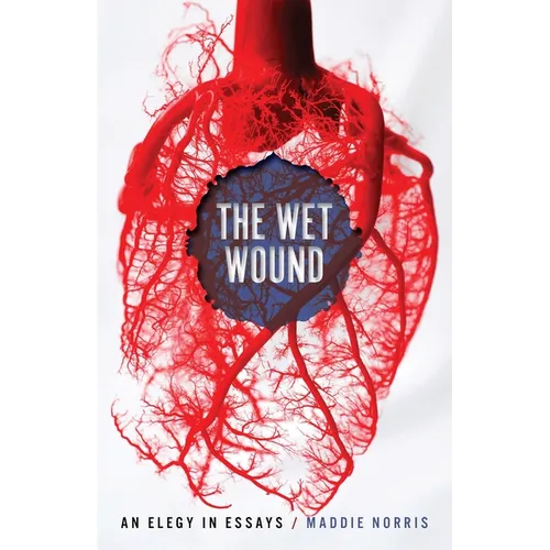 Wet Wound: An Elegy in Essays - Paperback